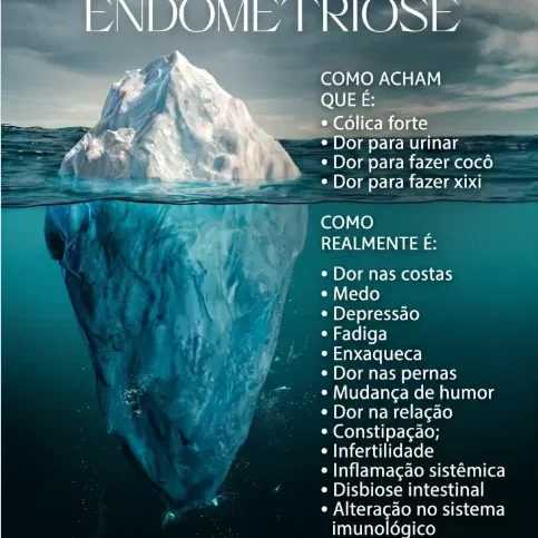 Post: o iceberg da endometriose — o que ela realmente é além da cólica